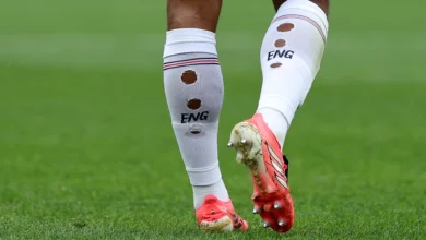 ظاهرة الجوارب الممزقة والأحذية المثقوبة تثير الدهشة في كأس العالم 2026