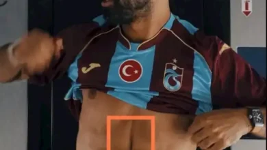 علامة غائرة في بطن محمد صلاح تثير تساؤلات حول قصتها