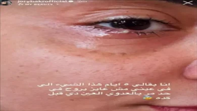 جوري بكر تكشف عن إصابتها بعدوى في عينها- ماذا قالت؟ 3 جوري بكر تكشف عن إصابتها بعدوى في عينها- ماذا قالت؟
