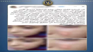 حرق وجه طالب بقداحة في مدرسة سوهاج: تفاصيل الحادث تكشفها وزارة الداخلية