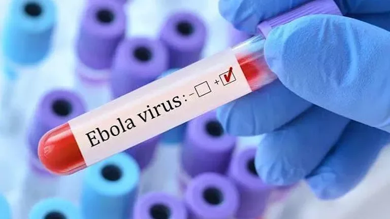 إصابات جديدة بفيروس إيبولا بين العاملين في القطاع الصحي بكينيا